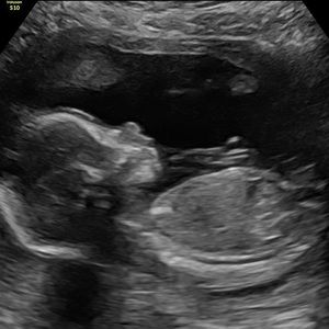 Meet your Posher, Regina